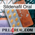 Sildenafil Oral 43